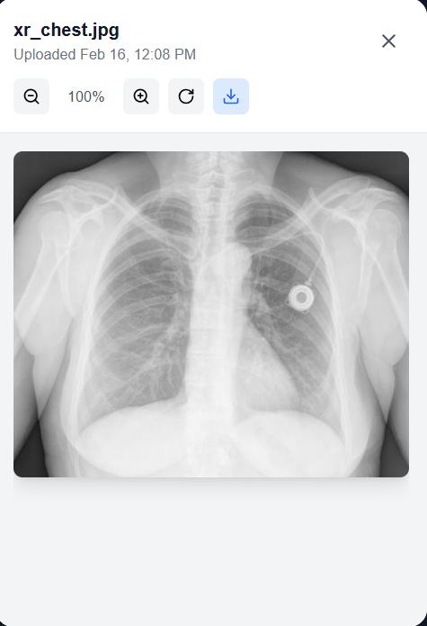 X-Ray